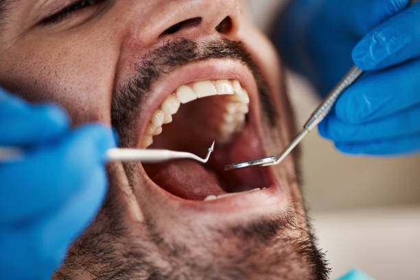 Best Walk-In Emergency Dentist in Rochester, IN